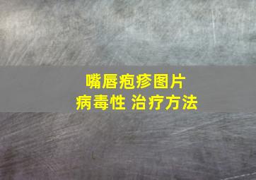 嘴唇疱疹图片 病毒性 治疗方法